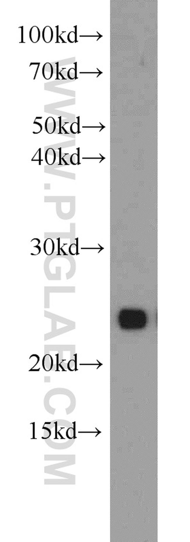 RAB11B Antibody in Western Blot (WB)