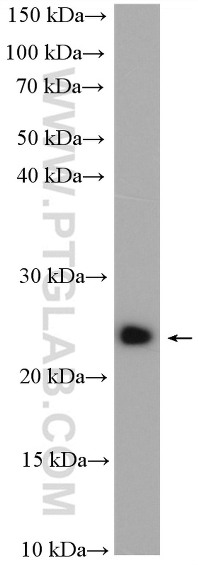 RAB11B Antibody in Western Blot (WB)