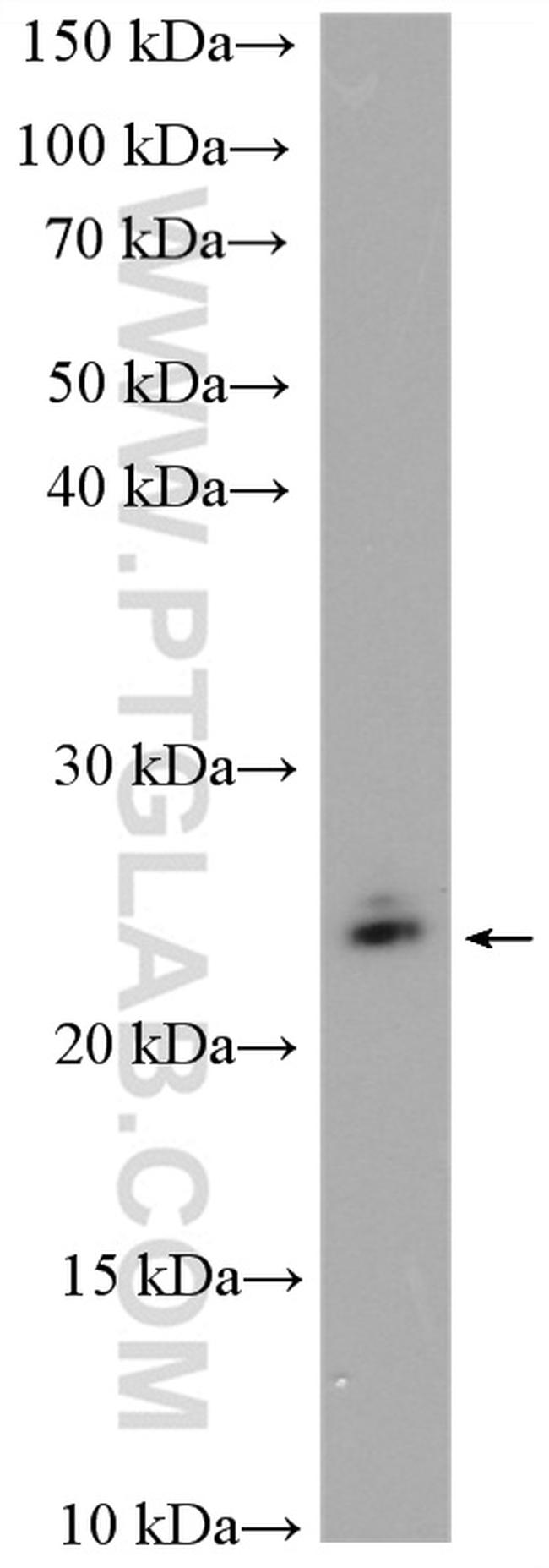 RAB11B Antibody in Western Blot (WB)