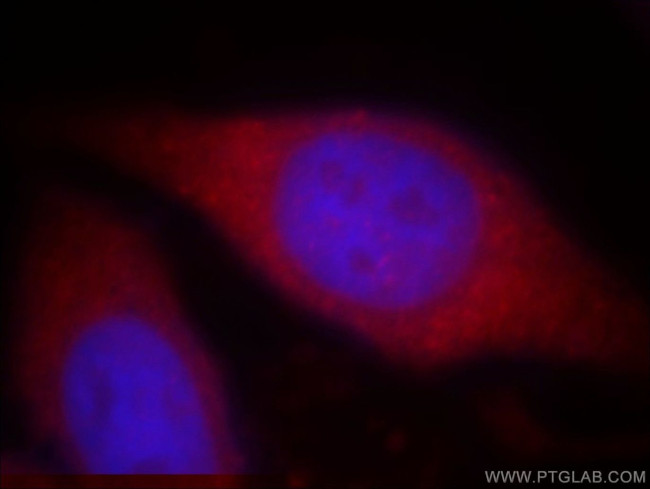 WASF4 Antibody in Immunocytochemistry (ICC/IF)