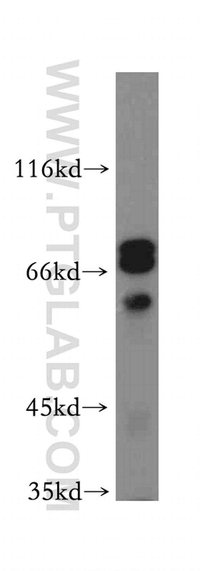 WASF4 Antibody in Western Blot (WB)