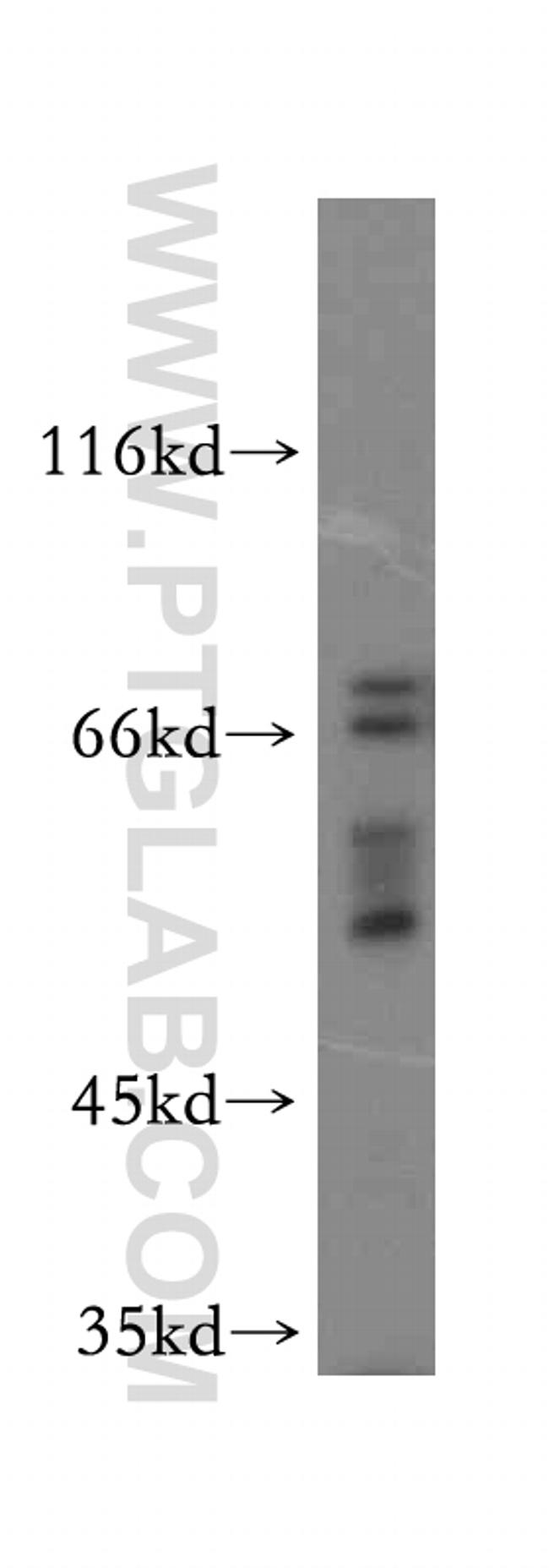 WASF4 Antibody in Western Blot (WB)