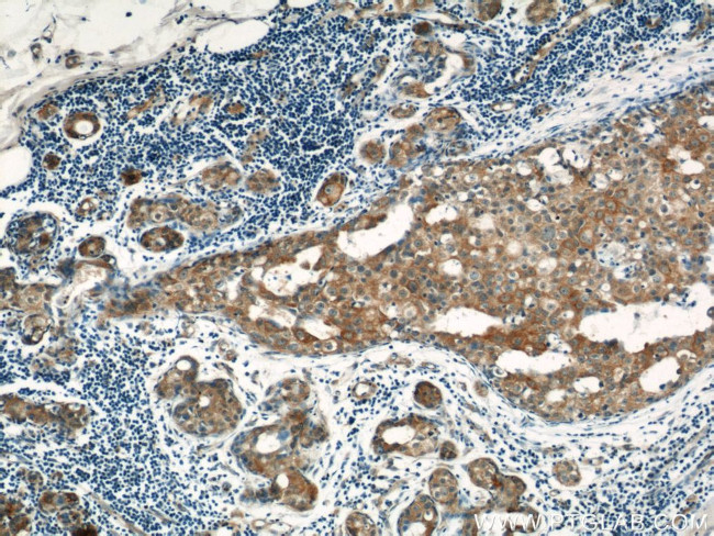 LATH Antibody in Immunohistochemistry (Paraffin) (IHC (P))