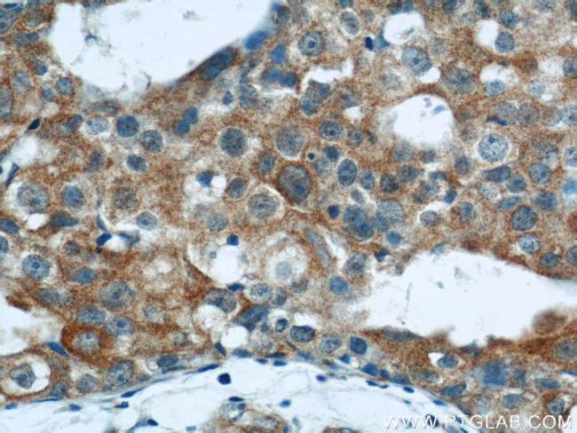 LATH Antibody in Immunohistochemistry (Paraffin) (IHC (P))