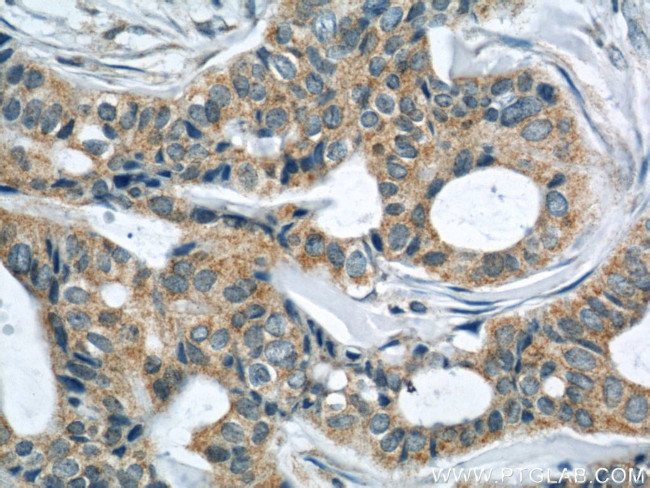 LATH Antibody in Immunohistochemistry (Paraffin) (IHC (P))