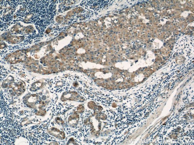 LATH Antibody in Immunohistochemistry (Paraffin) (IHC (P))