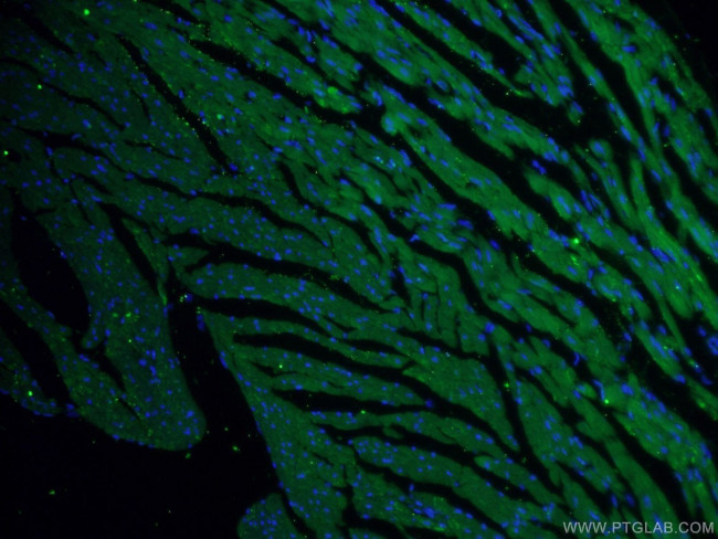 RYR2 Antibody in Immunohistochemistry (PFA fixed) (IHC (PFA))