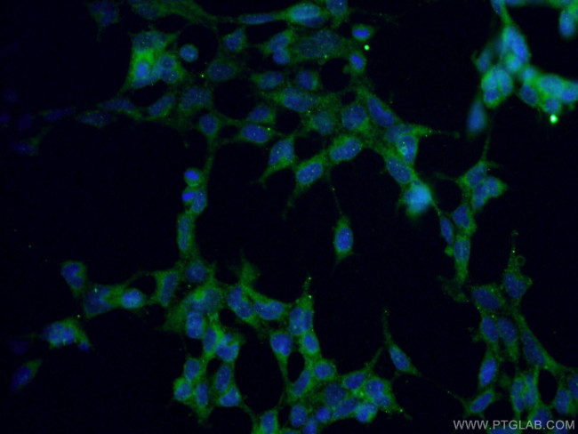 RYR2 Antibody in Immunocytochemistry (ICC/IF)