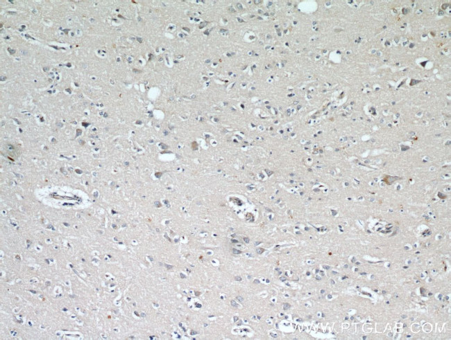 RYR2 Antibody in Immunohistochemistry (Paraffin) (IHC (P))