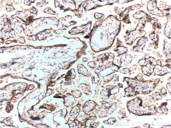 RYR2 Antibody in Immunohistochemistry (Paraffin) (IHC (P))