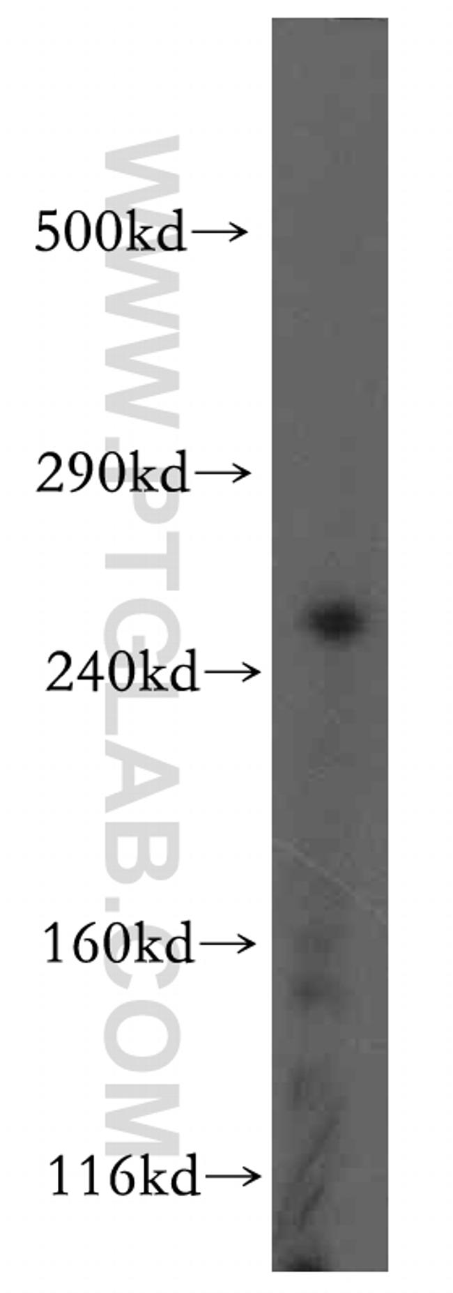 RYR2 Antibody in Western Blot (WB)