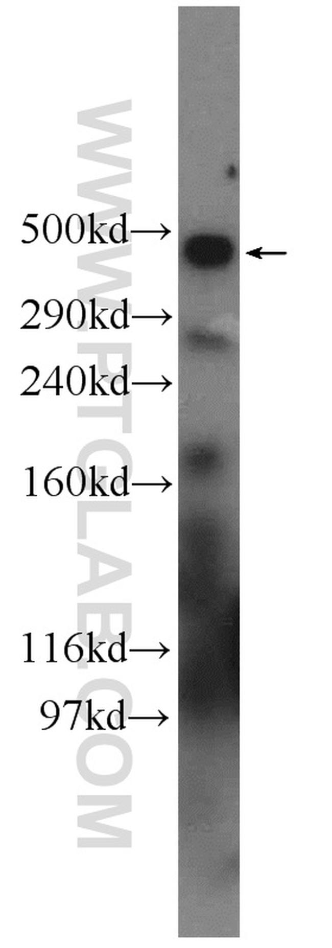 RYR2 Antibody in Western Blot (WB)