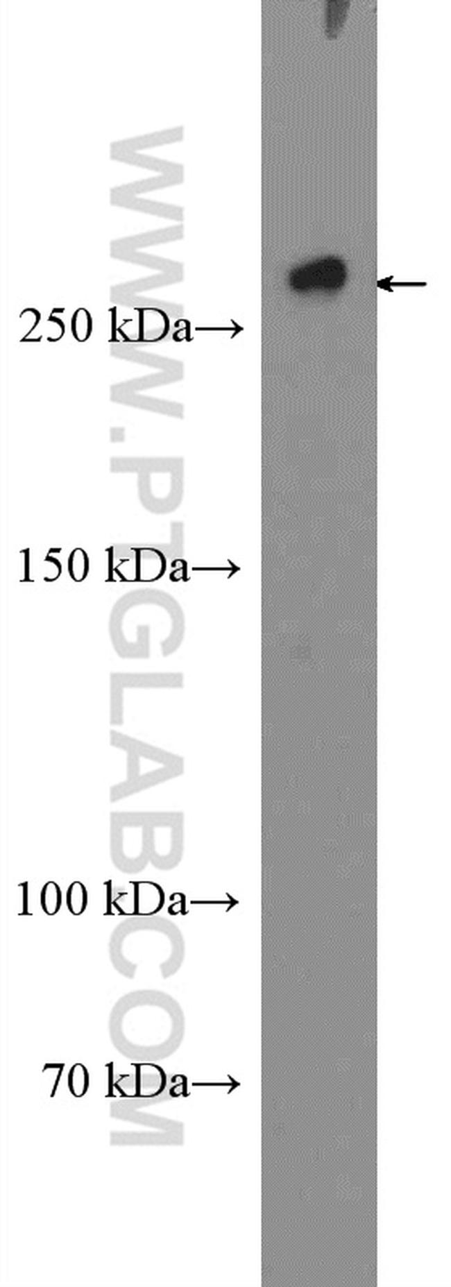 RYR2 Antibody in Western Blot (WB)