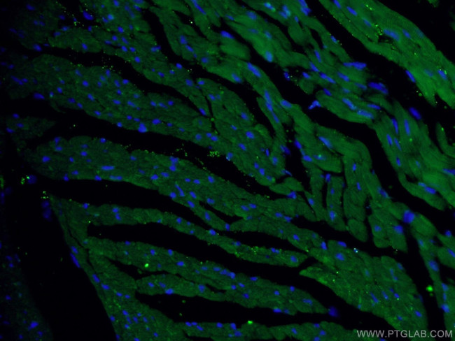 RYR2 Antibody in Immunohistochemistry (PFA fixed) (IHC (PFA))