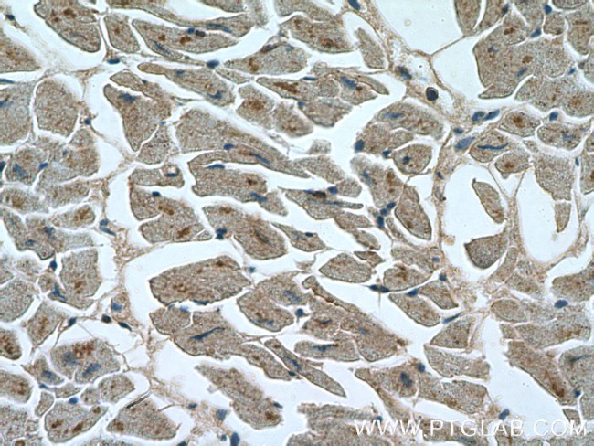 RYR2 Antibody in Immunohistochemistry (Paraffin) (IHC (P))