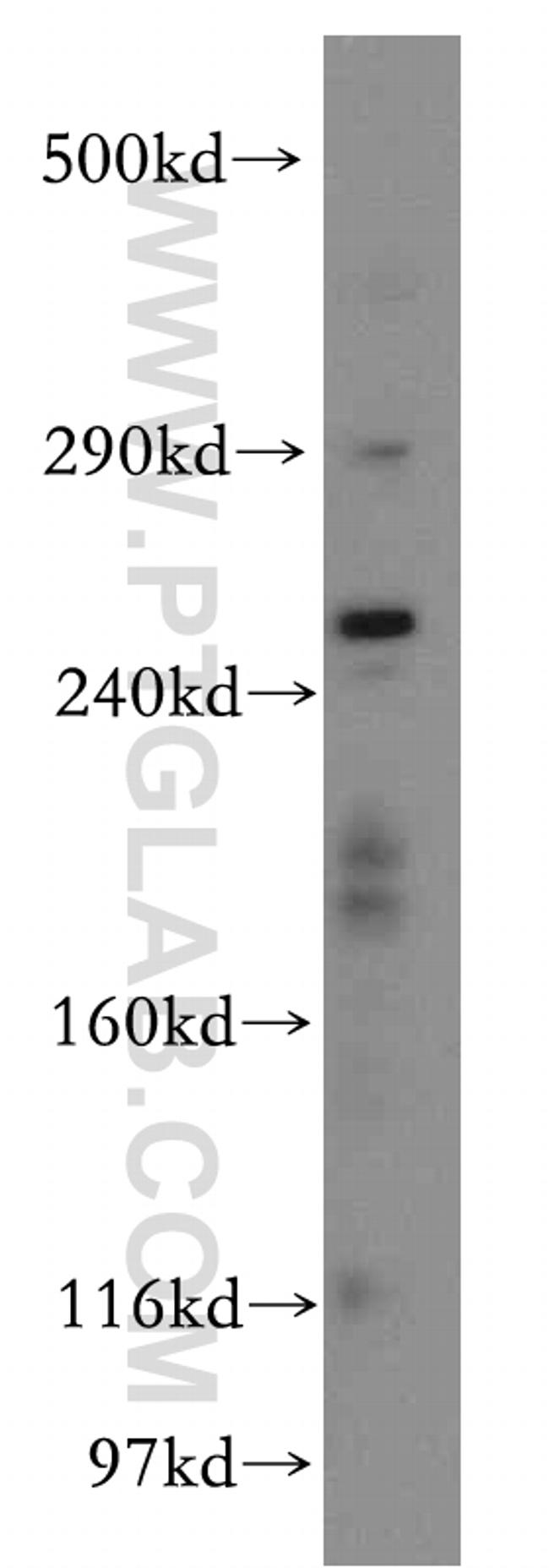 RYR2 Antibody in Western Blot (WB)