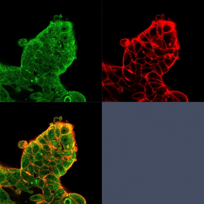 EIF4E Antibody in Immunocytochemistry (ICC/IF)