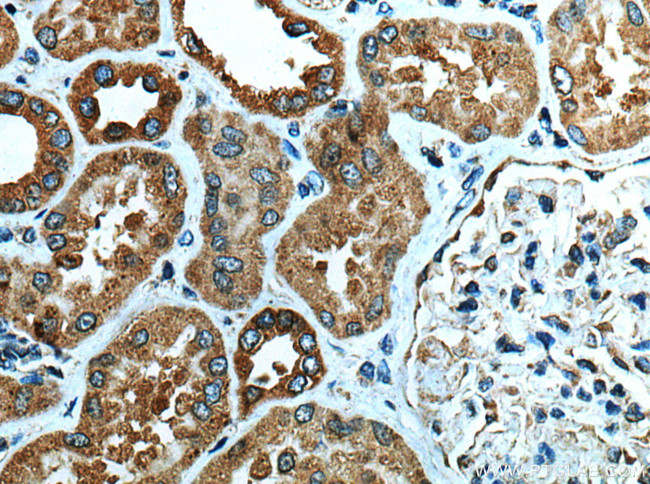 NLRP3 Antibody in Immunohistochemistry (Paraffin) (IHC (P))