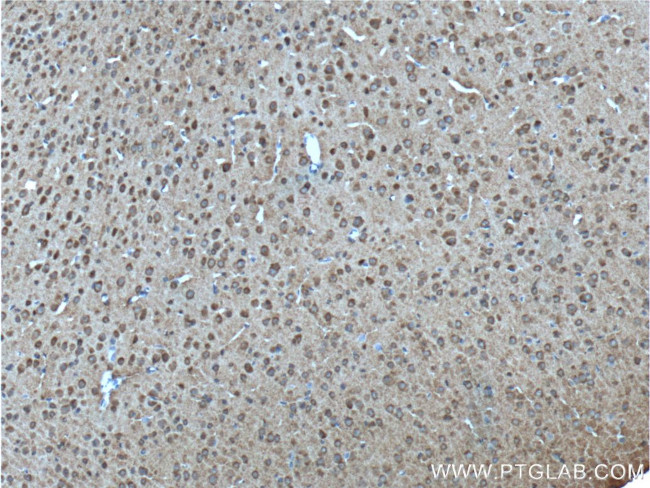 ADRA1B Antibody in Immunohistochemistry (Paraffin) (IHC (P))