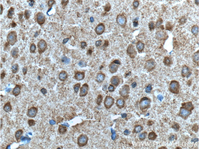 ADRA1B Antibody in Immunohistochemistry (Paraffin) (IHC (P))