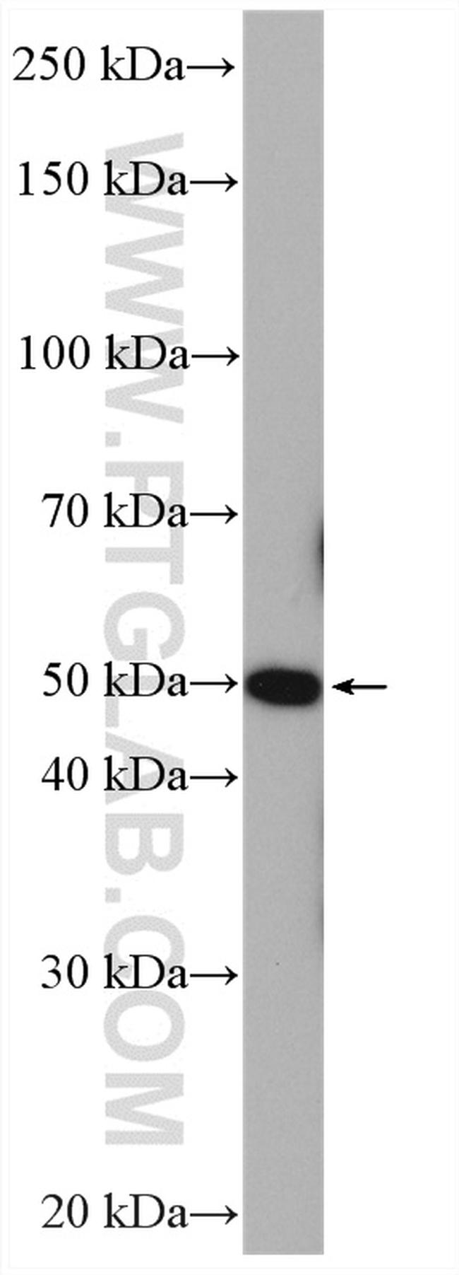 ADRA1A Antibody in Western Blot (WB)