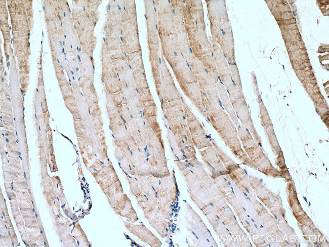 AMPD1 Antibody in Immunohistochemistry (Paraffin) (IHC (P))