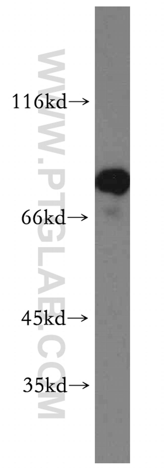 AMPD1 Antibody in Western Blot (WB)