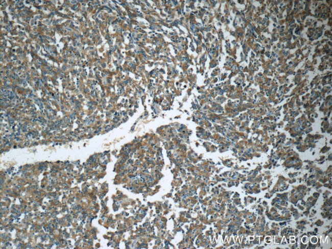 APC Antibody in Immunohistochemistry (Paraffin) (IHC (P))