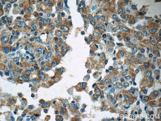 APC Antibody in Immunohistochemistry (Paraffin) (IHC (P))