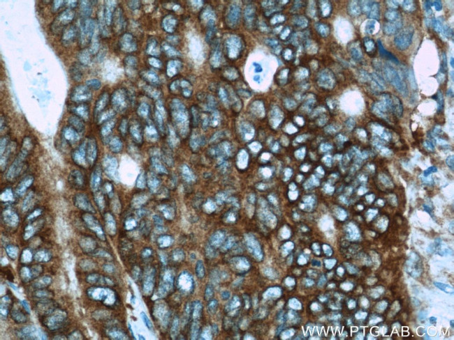 APC Antibody in Immunohistochemistry (Paraffin) (IHC (P))