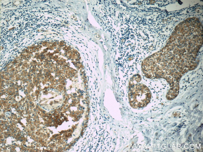 APC Antibody in Immunohistochemistry (Paraffin) (IHC (P))