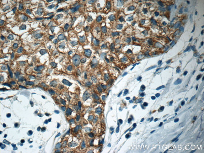 APC Antibody in Immunohistochemistry (Paraffin) (IHC (P))