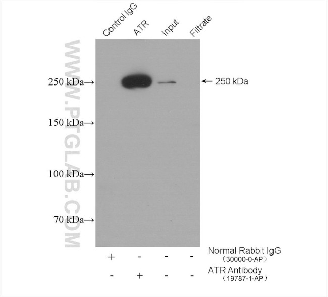 ATR Antibody in Immunoprecipitation (IP)