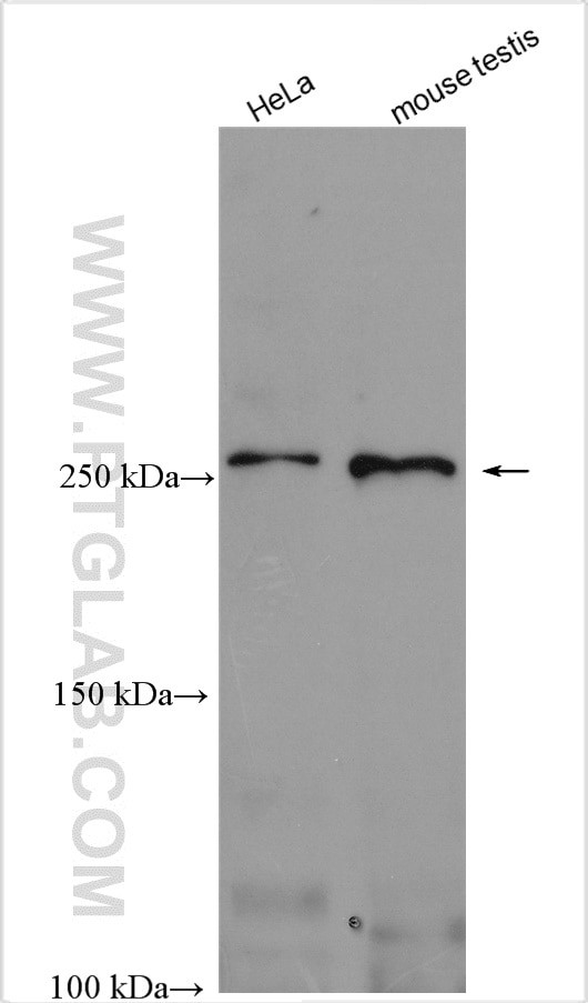 ATR Antibody in Western Blot (WB)