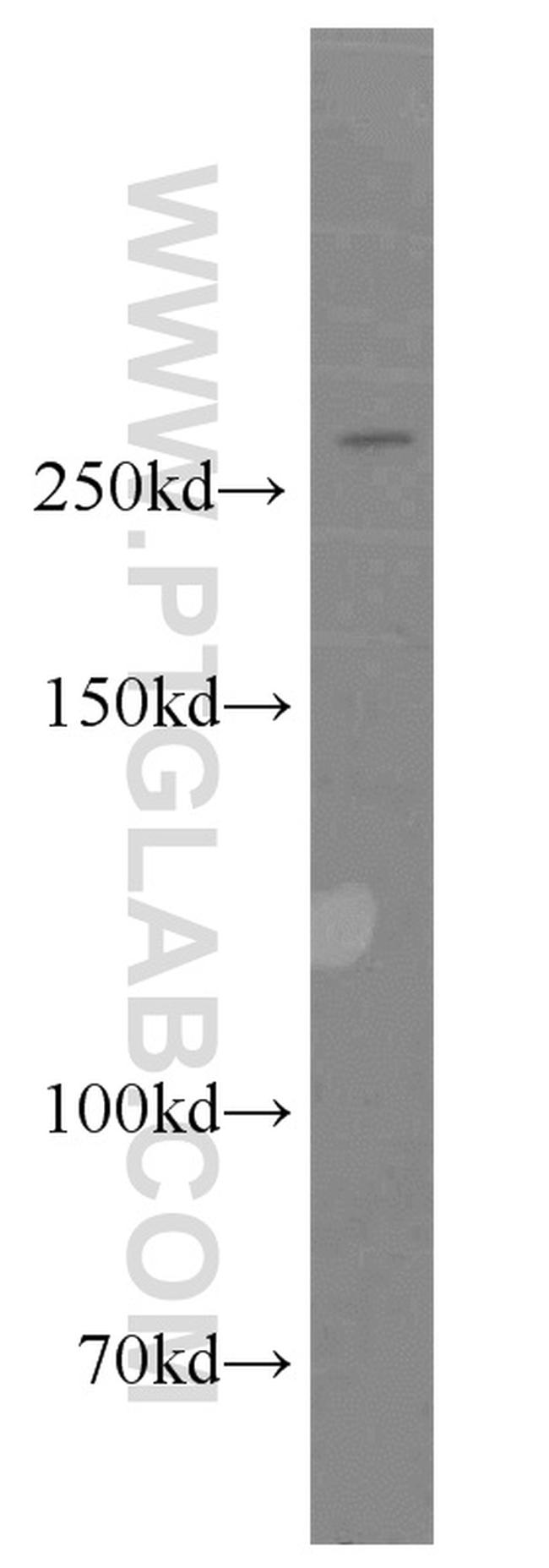 ATR Antibody in Western Blot (WB)