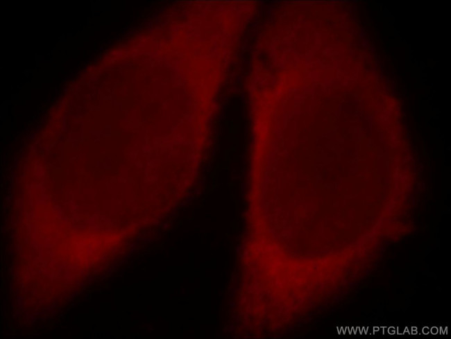 Catalase Antibody in Immunocytochemistry (ICC/IF)