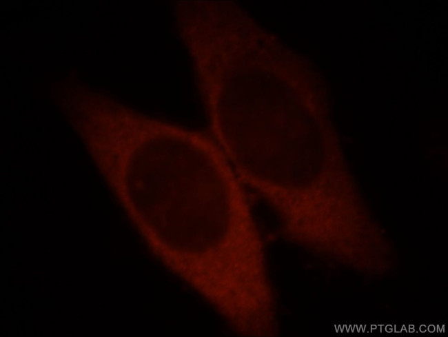 Catalase Antibody in Immunocytochemistry (ICC/IF)