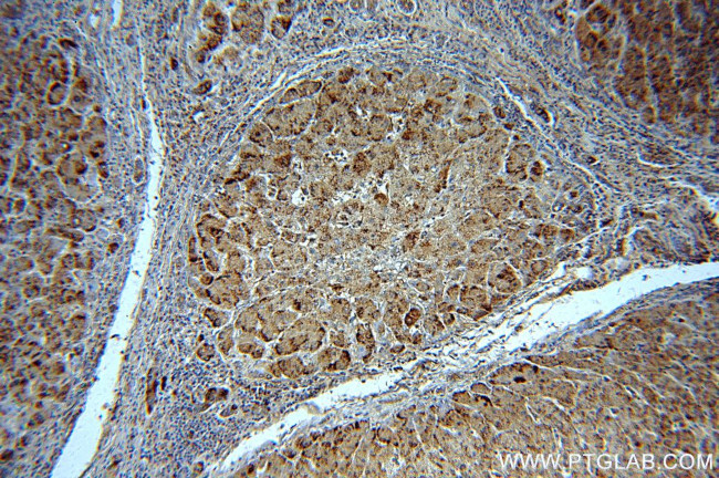 Catalase Antibody in Immunohistochemistry (Paraffin) (IHC (P))