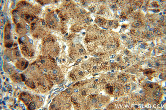 Catalase Antibody in Immunohistochemistry (Paraffin) (IHC (P))