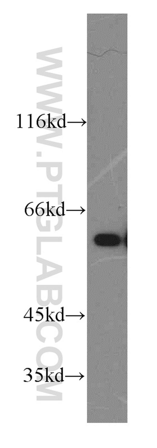 Catalase Antibody in Western Blot (WB)