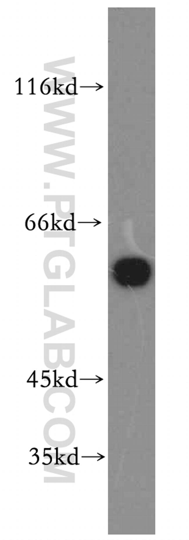 Catalase Antibody in Western Blot (WB)