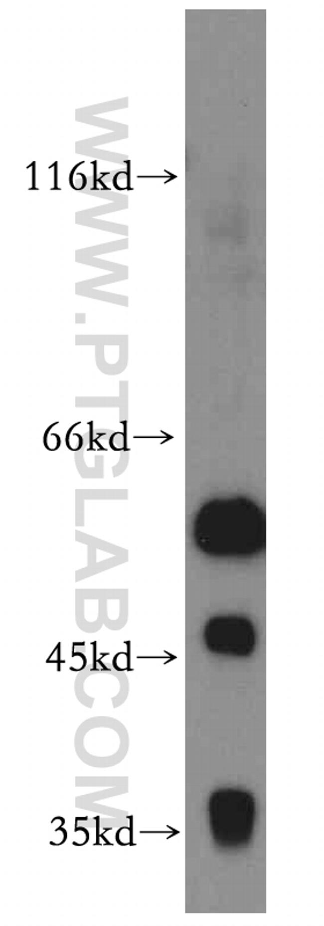 CCT6A Antibody in Western Blot (WB)