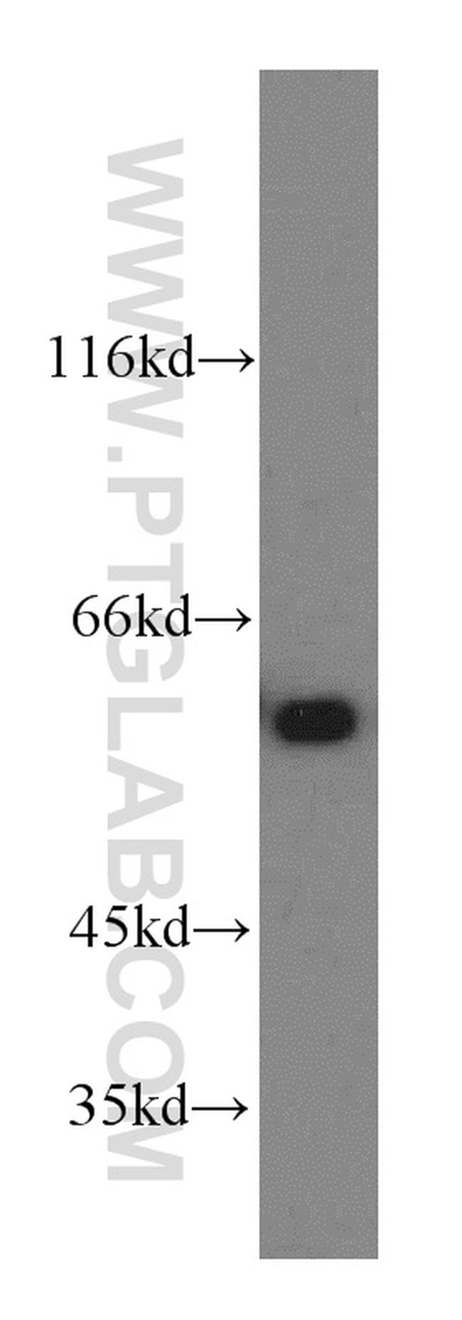 CCT6A Antibody in Western Blot (WB)