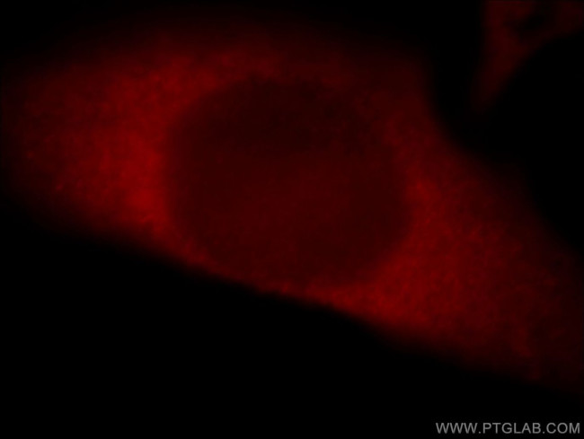 THUMPD3 Antibody in Immunocytochemistry (ICC/IF)