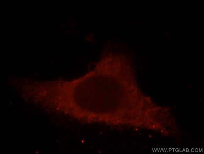 THUMPD3 Antibody in Immunocytochemistry (ICC/IF)