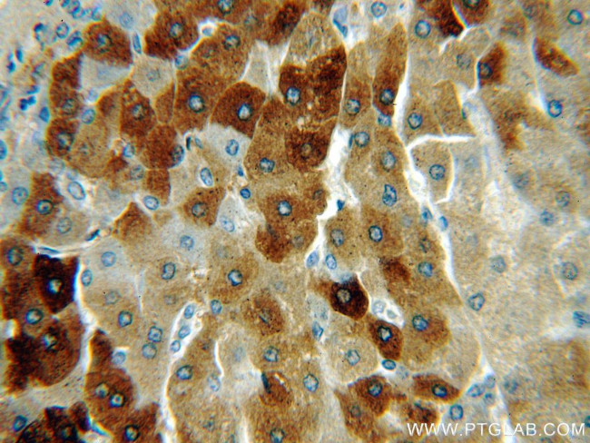 THUMPD3 Antibody in Immunohistochemistry (Paraffin) (IHC (P))