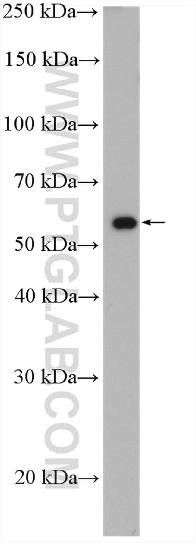 THUMPD3 Antibody in Western Blot (WB)