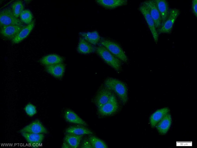 DHX32 Antibody in Immunocytochemistry (ICC/IF)