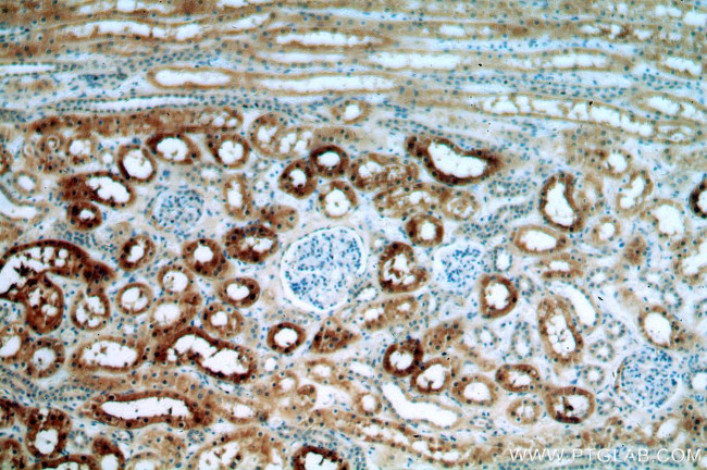 DHX32 Antibody in Immunohistochemistry (Paraffin) (IHC (P))