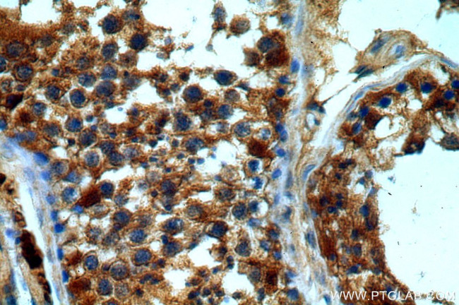 DHX32 Antibody in Immunohistochemistry (Paraffin) (IHC (P))